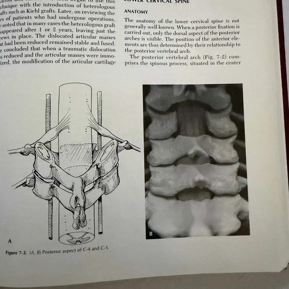 SPINAL TRAUMA By Thomas J. Errico & R. David Bauer - Hardcover